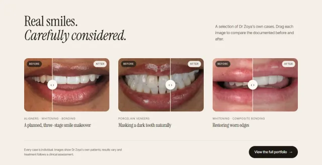 ‘Real smiles. Carefully considered.’ Three treatment cases, each a close-up of a mouth split down the middle by a draggable handle, labelled Before on the left and After on the right.
